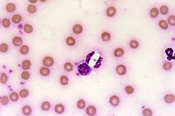Figure 11. Hepatazoon gametocyte. Image: Pedro Serra / NationWide Labs