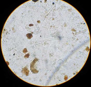 Figure 4. Sporulated Isospora species oocysts.