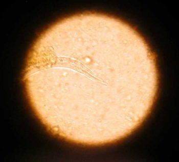 Figure 9. L1 Angiostrongylus larvae showing dorsal notch. Image: Pedro Serra / NationWide Labs