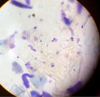 Figure 2b. Moderate numbers of Malassezia (×1000) in the West Highland white terrier (Figure 2a).