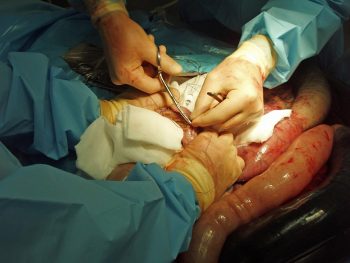 Figure 7. The majority of colic cases can be managed medically, but those requiring surgical treatment must be rapidly identified and referred. Image: XLEquine image archive.
