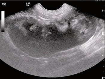 Figure 1a. An ultrasound image of a kidney affected by lymphoma. The kidney is enlarged, nodular and irregular. Image: Anderson Moores Veterinary Specialists.