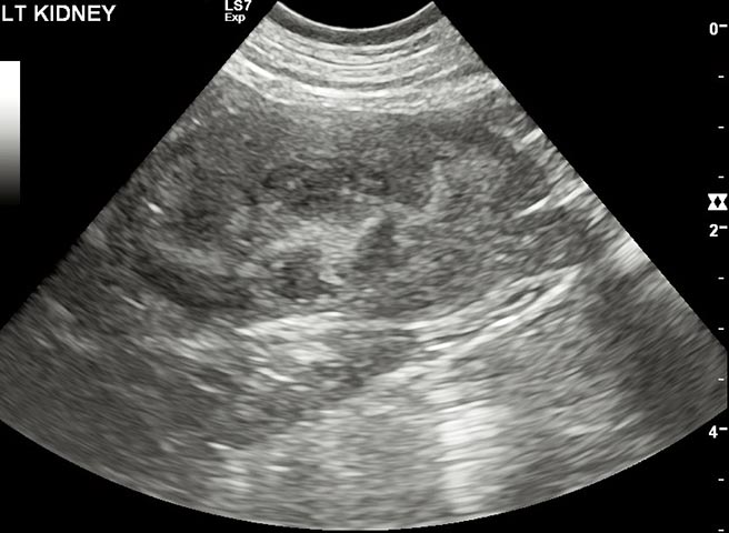 Figure 1b. An ultrasound image of a kidney affected by chronic kidney disease. The kidney is slightly small and irregular, with reduced corticomedullary definition. Image: Anderson Moores Veterinary Specialists.