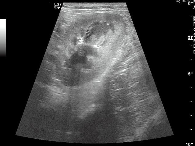 Figure 1c. An ultrasound image of a healthy canine kidney. Image: Anderson Moores Veterinary Specialists.