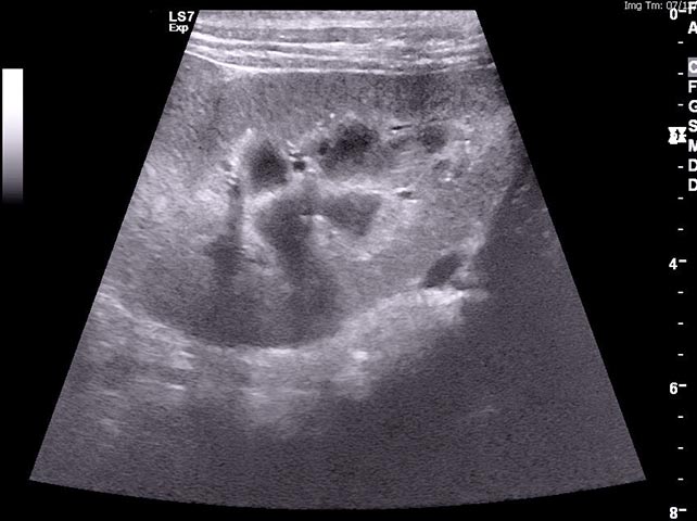 Figure 1d. An ultrasound image of the kidney of a dog with cutaneous and renal glomerular vasculopathy. The kidney is mildly hyperechoic. Some cases have had reduced corticomedullary definition, but generally any changes are mild. Image: Anderson Moores Veterinary Specialists.