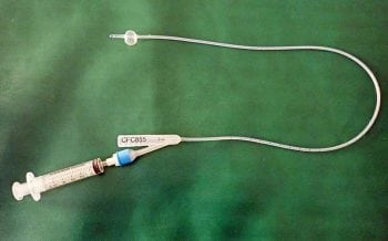Figure 3. A Foley urinary catheter. The inflated balloon holds the catheter in place in the bladder.