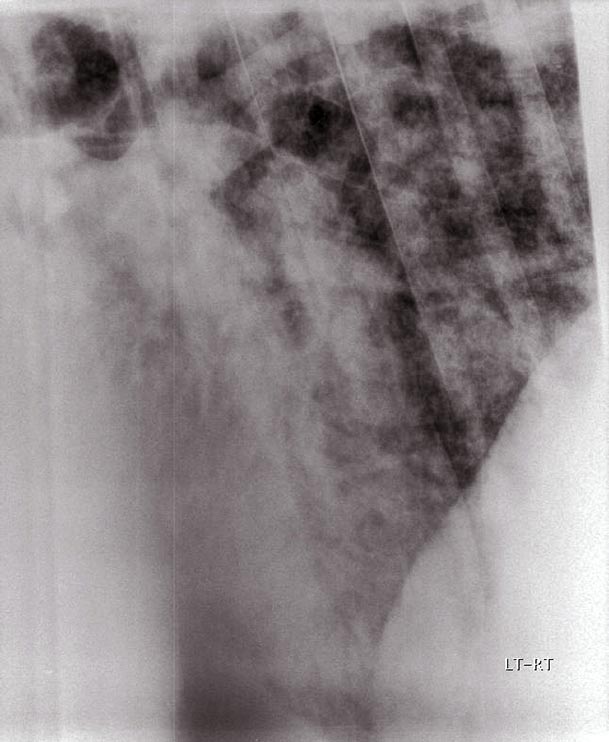 Figure 3. A laterolateral radiograph of the caudoventral lung field of an adult horse with interstitial pneumonia. Note the uneven and poorly defined increases in opacity throughout the pulmonary parenchyma consistent with an alveolar interstitial pattern.