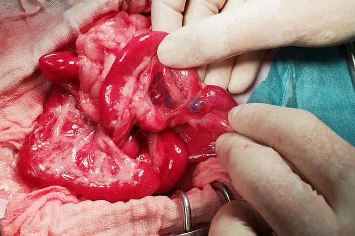 Figure 2. The lymph node resection.