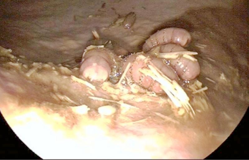 Figure 4. Gasterophilus species larvae attached to the gastric mucosa at the level of the margo plicatus.