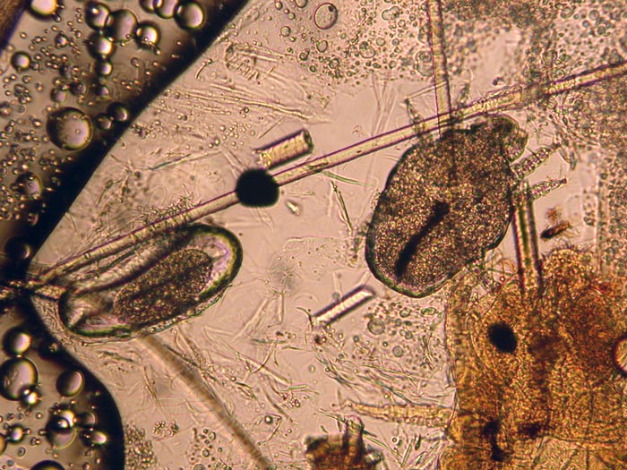 Figure 8. A Cheyletiella mite on a superficial skin scraping.