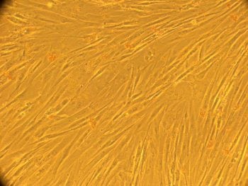 Figure 3.  Amber’s stem  cells on microscope  (×100 magnification).