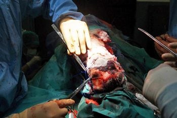 Placing the skin grafts within the releasing incisions over the muzzle.