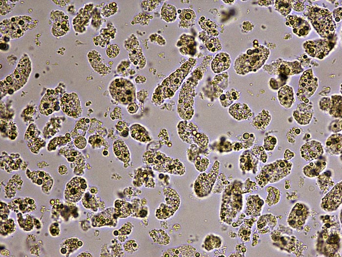 Image from a urine sediment from an adult male cat with acute history of vomiting and oliguria.