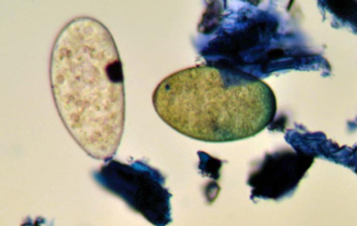 Figure 1. Faecal sample containing a rumen fluke egg (left) and a liver fluke egg (right).