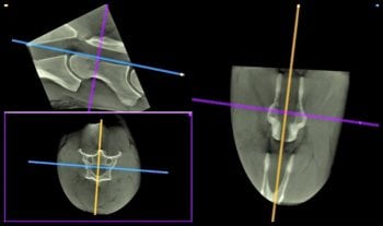 Figure 4. Transverse images, and sagittal and dorsal reconstructions of C4-C5 obtained in a standing adult horse. Images: Werner Jahn, Pferdeklinik Bargteheide.