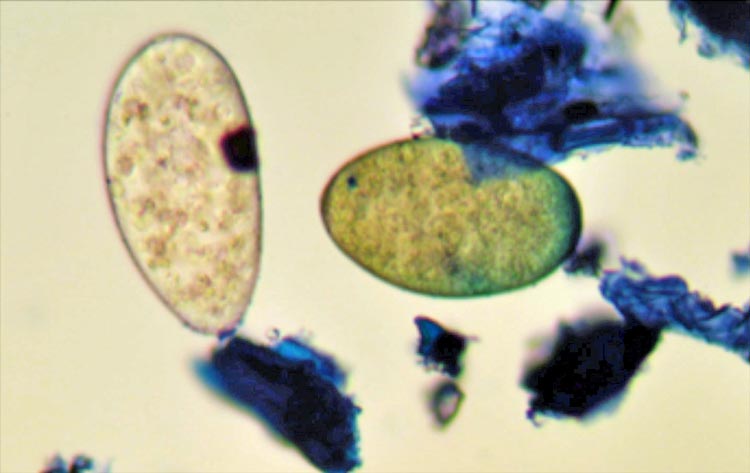 Figure 2. Faecal sample containing a rumen fluke egg (left) and liver fluke egg (right). Image: Philip Skuce / Moredun Research Institute.