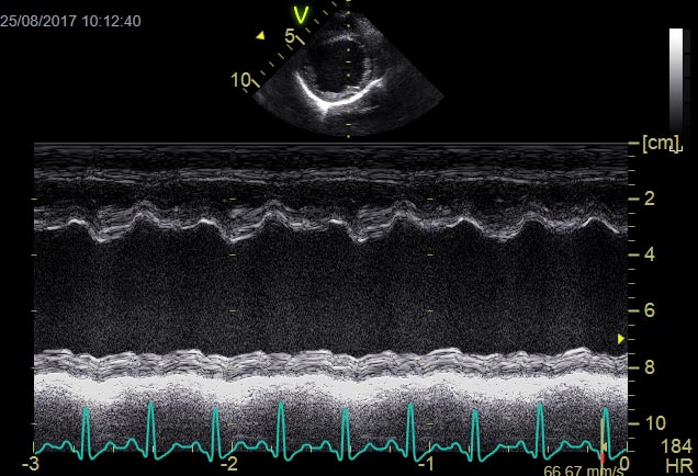 Figure 1b. M-mode of the left ventricle of a Labrador retriever with DCM, showing a severe reduction in fractional shortening – an indicator of systolic function.