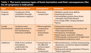 Table 1. The most common types of brain herniation and their consequences (the list of symptoms is indicative).