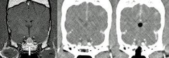 Figure 1. A proposed systematic approach to a case of canine hyperadrenocorticism with marked dermatological abnormalities. The CT images show pre-hypophysectomy and post-hypophysectomy. Image: Langford Veterinary Services.