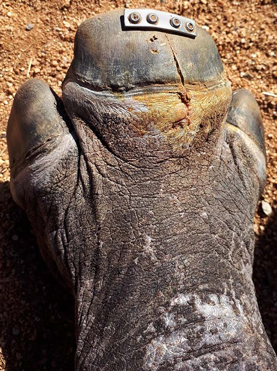 Arthur's foot wound.