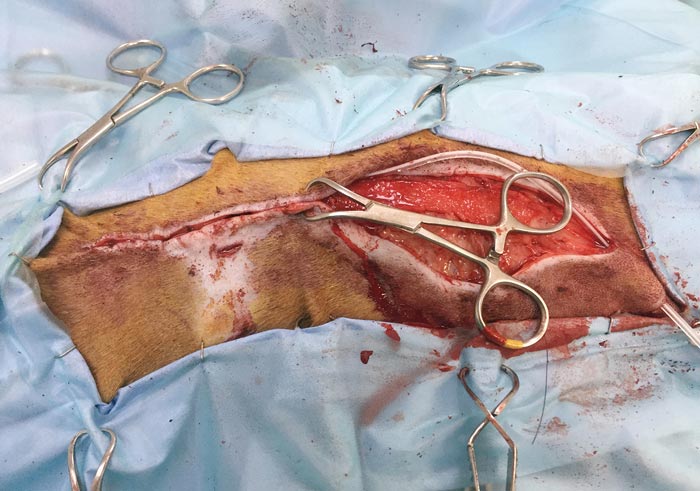 Figure 2b. A secondary closure of the wound was performed 11 days after initial presentation.