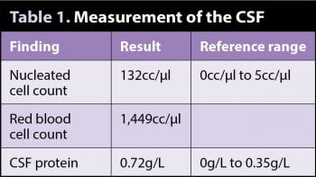 Table 1. Measurement of the CSF.
