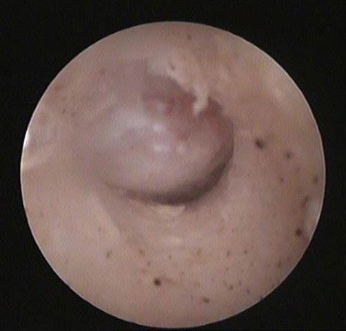 Figure 1. Polyp in the external ear of a cat.