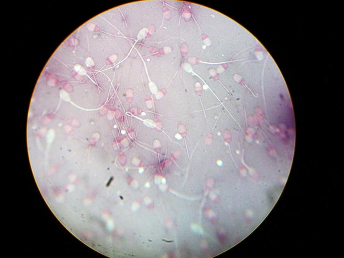 Figure 13. Negrosin-eosin stained semen for morphology assessment.