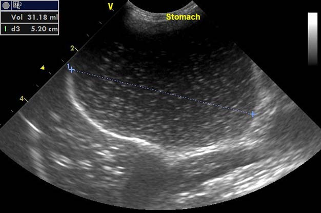 Figure 2a. An ultrasound of a cat presenting with an obstructive small intestinal foreign body showing dilated stomach.