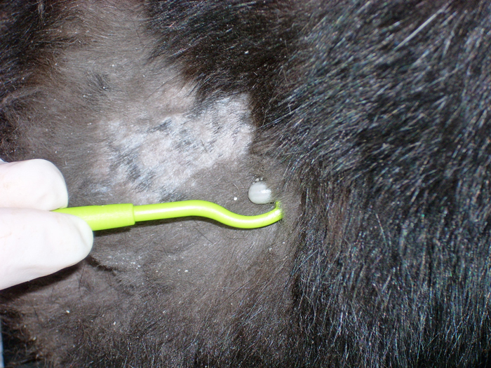 Removal of a tick with a tick hook.