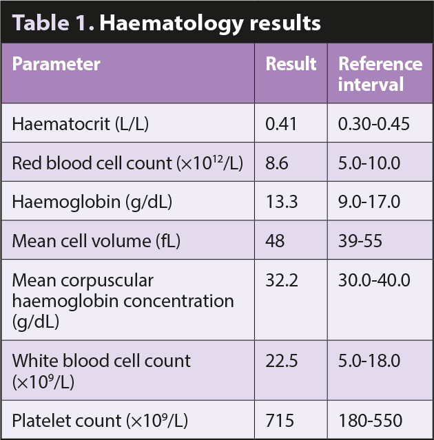 Table 1. Haematology results.