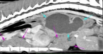 Figure 4b. A three-year-old male neutered Maine Coon cat was diagnosed with a pyothorax cytologically. Further imaging with ultrasound and CT revealed a presence of a paraoesophageal abscess. This is the thoracic CT. The cyan arrows show the abscess, while the purple arrows show inflammatory tissue within the pleural space. This case would have been very unlikely to resolve with conservative management, but the patient made a complete recovery following a thoracotomy with debridement of the abscess.