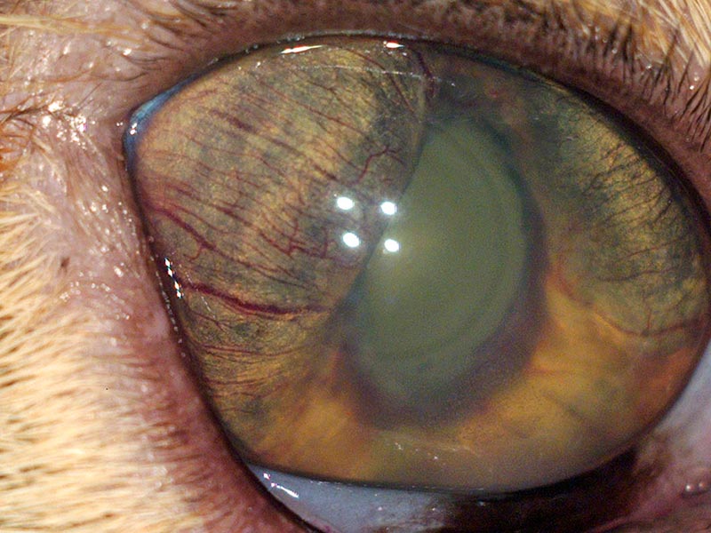 Figure 2. Severe uveitis in this eye caused 360° adhesion between the iris and lens. Consequently, aqueous humour cannot flow from the posterior into the anterior chamber. This results in elevated pressure in the posterior segment of the eye and the forward bowing of the iris (iris bombé) evident in this image. This forward movement also causes adhesions between the peripheral iris and cornea – closing the iridocorneal angle and further elevating pressure in the eye.