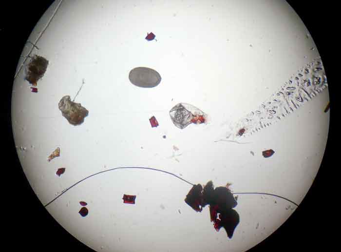 Figure 2. Flea dirt and egg.