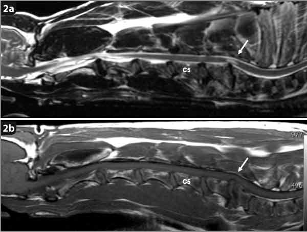 Figure 2. T2-weighted (2a) and T1-weighted (2b) sagittal MRI scans of a seven-year old Dobermann with disc-associated cervical spondylomyelopathy. A collapsed intervertebral disc space between C6-C7, associated with a C6-C7 intervertebral disc protrusion, can be seen (arrow). The C7 vertebra has an abnormal shape and the craniodorsal tip is tilted into the vertebral canal. A T2-weighted hyperintensity can be seen in the spinal cord at the level of the spinal cord compression. This hyperintensity is often seen in chronic spinal cord compressions and is not necessarily associated with a more guarded prognosis.