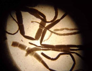 Dipylidium caninum adult tapeworms. Image: John McGarry, University of Liverpool