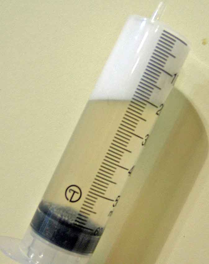 Figure 3. A foamy bronchoalveolar lavage sample indicating an effective lavage of the alveoli.