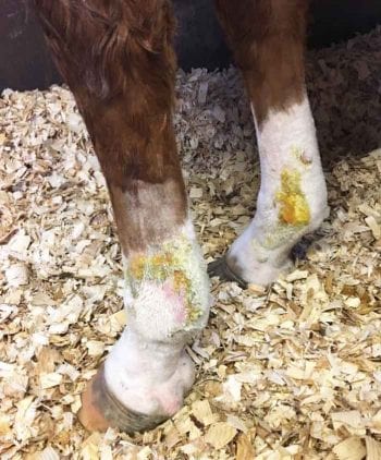 Figure 4. Pastern leukocytoclastic vasculitis.