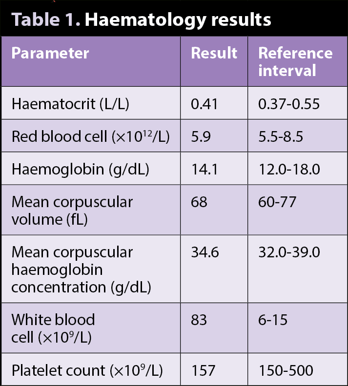 Table 1. Haematology results.