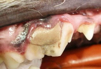 Figure 3. Complicated crown fracture of the maxillary fourth premolar with a necrotic pulp.