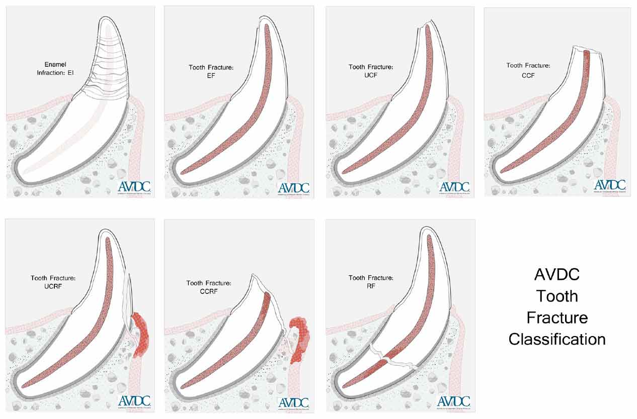 Canine Dog Teeth Chart