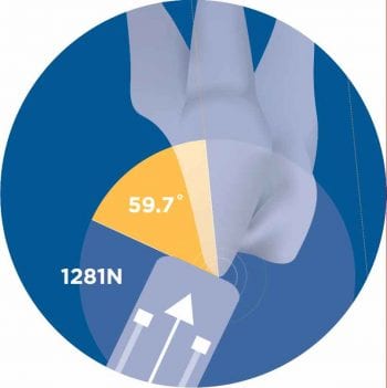 Figure 5. Illustration showing the maximum force required to fracture the carnassial at the mean impact angle.