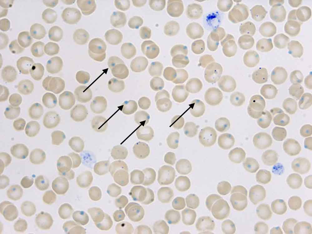 Figure 2. The cat’s blood smear with new methylene blue stain.