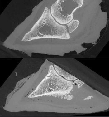 Figure 1. New bone formation on the pedal bone following a case of lameness is hypothesised to increase a cow’s risk of becoming lame in the future. Image: CC BY-SA 4.0 https://bit.ly/1xMszCg