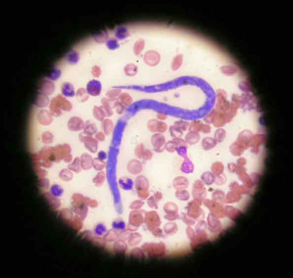 Figure 1. The microfilaria heartworm. Image: Pedro Serra / NationWide Labs