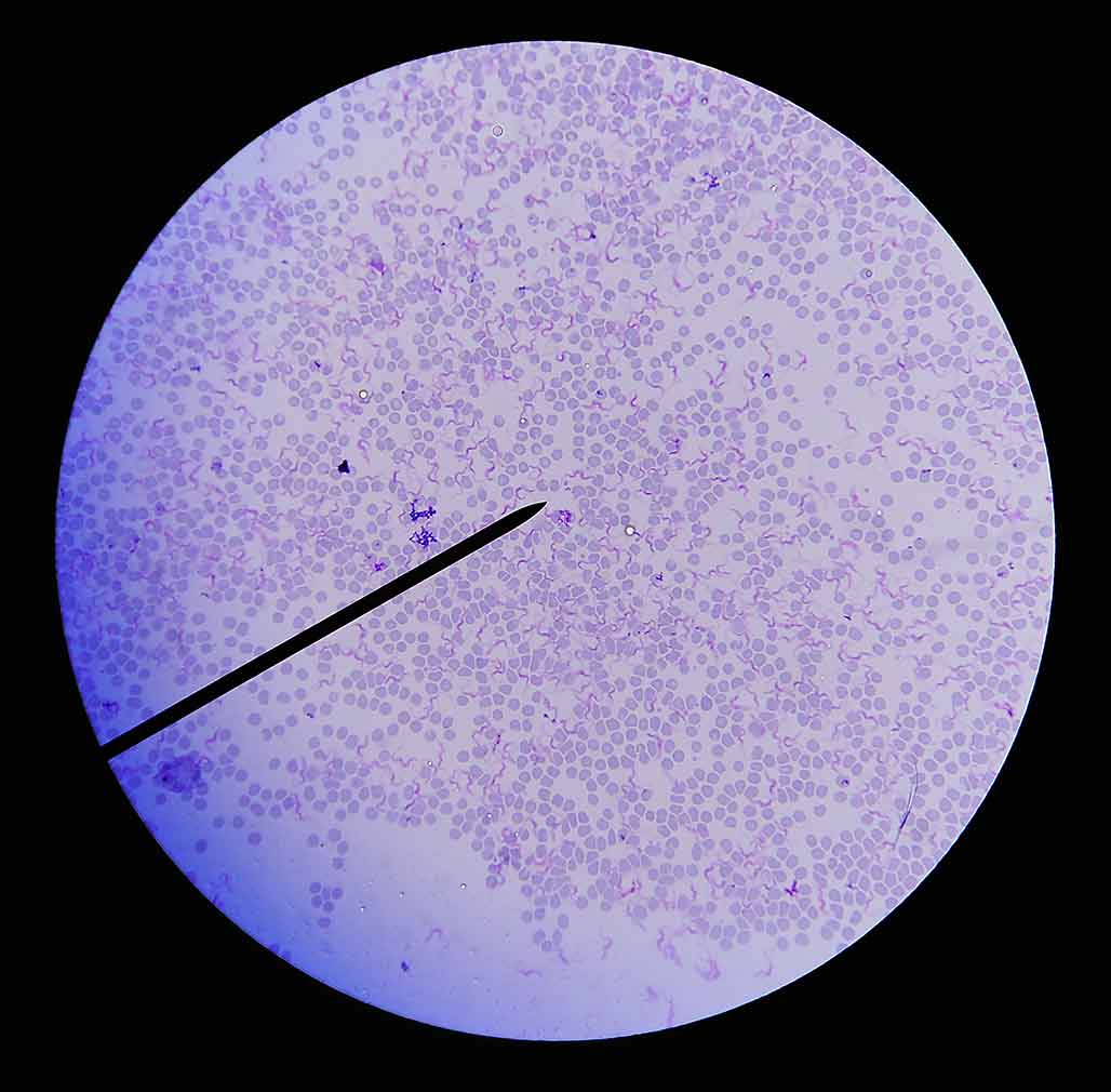 Figure 3. Trypomastigotes on a blood smear.