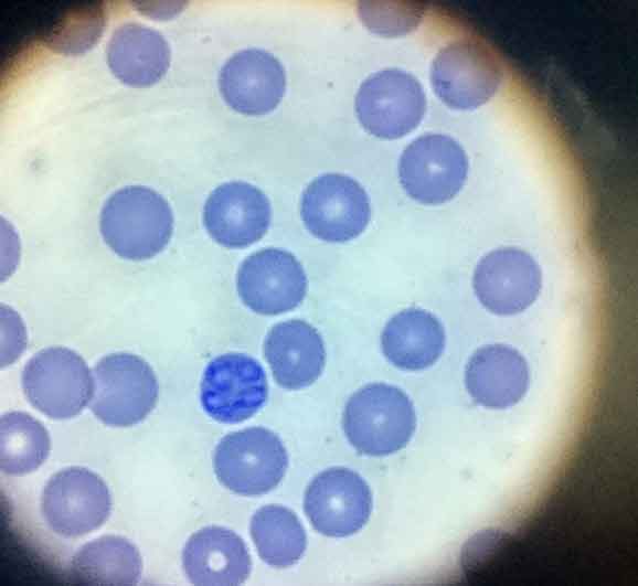 Figure 4. Babesia species piroplasms. Image: Simon Bate, Aberdeen Veterinary Referrals