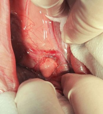 Figure 1. Gross appearance of the abnormal left adrenal gland during exploratory laparotomy.