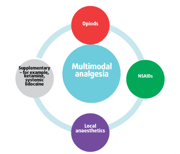 Figure 1. Multimodal analgesia.