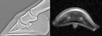 Figure 1. Lateromedial radiograph (left) of the foot of a horse with acute-onset foot pain that was exacerbated when turning, with increased amplitude of digital pulses and a painful response to the application of hoof testers to the toe region. The horse had recently been moved to a new yard with lush grass in the paddocks. The ratio between the hoof wall to distal phalanx distance (2.02cm) and the palmar length of the distal phalanx (7.16cm) is 0.28, which represents a thickened dorsal hoof wall. The horse underwent MRI several weeks later due to ongoing mild forelimb lameness localised to the foot by performing diagnostic analgesia. The image on the right is a fat-suppressed transverse image of the distal phalanx. There is diffuse hyperintense signal around the dorsal periphery of the distal phalanx, especially on the dorsomedial and dorsolateral aspects. This represents fluid-based bone pathology at the cortical lamellar interface. This horse had chronic subclinical laminitis with a history of acute exacerbation, most likely brought on by a dietary change.